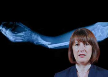 Osteoporosis prevention