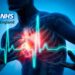 cardiovascular disease NHS
