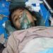 The US had attacked a hospital in Yemen for a second time